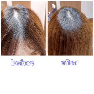 大野城美容室Lien hair design (リアンヘアーデザイン)『ヘアリセッター』のお客様です！  くせ毛で髪がひろがってしまう・・・ つむじ、前髪が割れてうすくみえる・・・ 美容室ではキレイでも自分ではうまくセットできない！  皆さんはこのような悩みをお持ちではないでしょうか？  今まで美容室でこのような悩みを打ち明けても、　”生えグセなのでしょうがないです”　と言われ、諦めたりしてきていませんか？  実はこれリアンなら改善できちゃいます！  そのような方に効果的なのがこのヘアリセッター です😊  長さを変える事なく、薬剤など一切使わずに、このような悩みを解決できます！  ■どのような悩みが改善できるのか 一般的に、髪の毛は１つの毛穴から２～５本はえています。 目ではわかりにくいのですが、その髪の毛たちは絡まりあってはえています。 その絡まりが原因で  ・髪が広がってしまう。 ・前髪、襟足、つむじの割れ、浮き。 ・トップのボリュームが出ず、ペタッとする。 ・手触りが悪い。 ということがおこってしまいます。  ヘアリセッターとは髪の根元の絡まりをとり、生えグセの強い髪のみを1本単位で根元から施術することにより、髪の長さを変えずにあなたの悩みを改善にみちびいてくれる魔法の技術なのです😁  髪の根元の絡まりをとるとどうなるのでしょうか。  ・髪の広がりが収まる。 ・前髪、つむじが割れにくくなる。 ・襟足が落ち着いて沿いやすくなる。 ・トップのボリュームが出やすくなる。 ・ツヤ、手触りが良くなる。  ということがおこります！  こちらのつむじの割れ目が気になっていたお客様もブローやドライもちろんアイロンもなしで『ヘアリセッター』のみで、こんなに綺麗に分け目を修正することができちゃいます😊  しかもドライヤーで風を吹き付けても今までのようにパカーンと割れることはないのです😆  ・前髪が生え癖で割れてしまう。 ・トップにボリュームがでない。 ・トップが膨らんでしまう。 ・つむじが割れてしまう。  これも全て下から持ち上げる毛や上からへばり付かせる髪が原因なのです😩 その原因になってる髪だけにピンポイントでアプローチすれば、こんなに艶々で綺麗に改善できちゃいます！  ■持ちは？ 基本的に約1ヶ月が持続期間です。 髪の毛は1ヶ月で約1センチ～1.5センチ伸びますので、伸びた毛が絡まり出すと生えグセが戻ってきます。しかし、完全に元に戻る前に施術を繰り返していくと、持ちや効果が良くなっていきます。  前髪やつむじなどの生え癖で悩まれているお客様、是非１度ヘアリセッターをお試しになられてください😊  #ヘアリセッター #美容室 #美容院 #福岡 #福岡県 #福岡ママ  #福岡美容室  #福岡県 #福岡県飯塚市  #福岡県福岡市  #福岡県大野城市  #大野城 #大野城市  #大野城市ママ  #大野城ママ  #大野城市美容室  #大野城美容室  #大野城駅  #大野城市下大利  #井尻  #井尻駅  #井尻美容室  #飯塚 #飯塚市  #飯塚市美容室  #飯塚美容室  #南区井尻  #福岡市南区  #福岡市南区井尻  #福岡市南区美容室